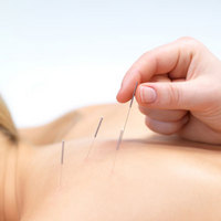 Medical Acupuncture Society